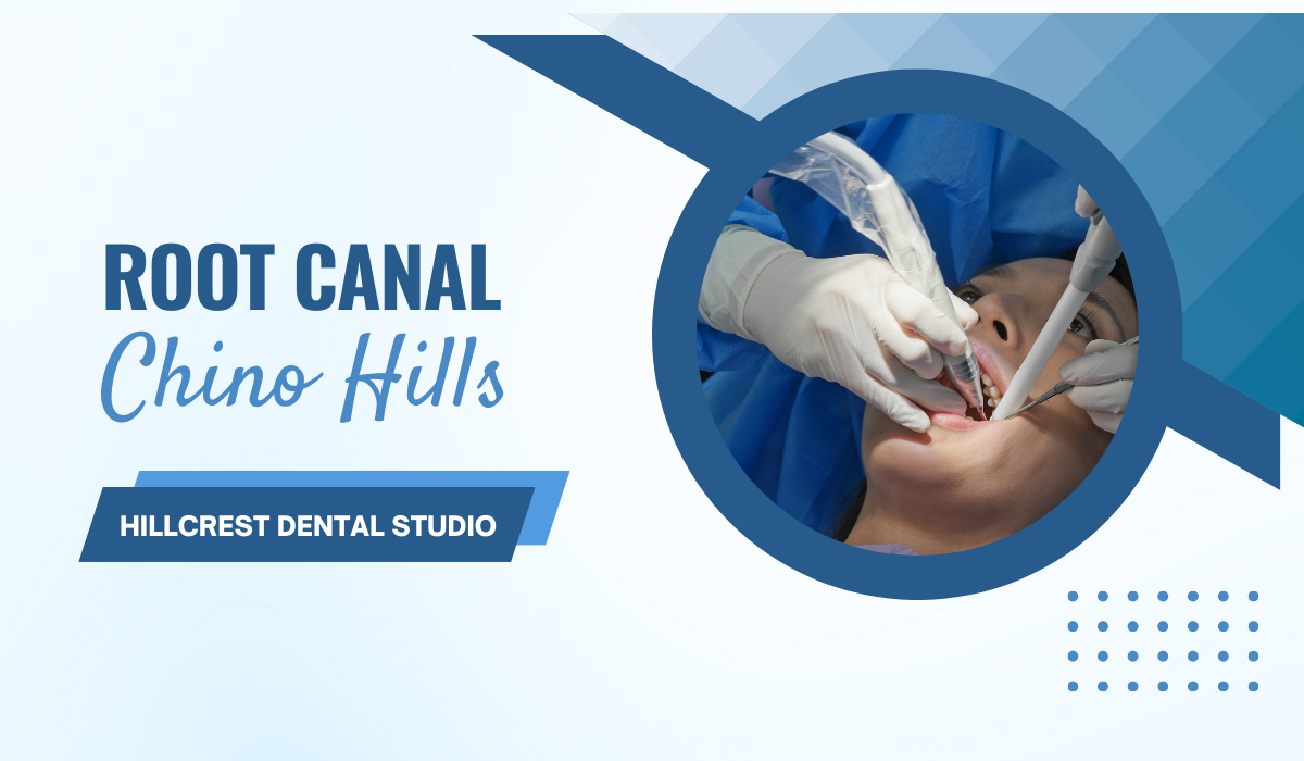 Root Canal in Chino Hills